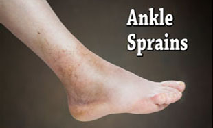 ankle sprain2