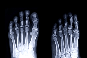 The Foot as the Foundation for Balance