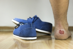 Cotton Socks and Blisters