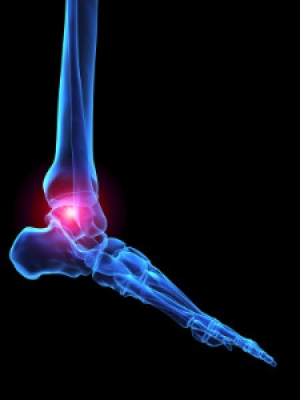 Arthritis and the Toes