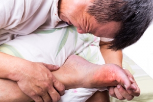 Risk Factors for Gout