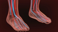 Causes of Peripheral Neuropathy