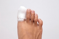 How Can I Support My Broken Toe as It Heals?