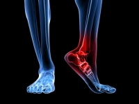 Where Is Pain Felt With Tarsal Tunnel Syndrome?