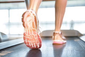 Poor Foot Biomechanics