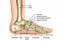 Types of Accessory Navicular